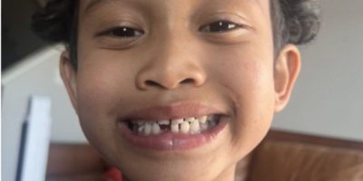 Kofi Berkley, who had an anaphylactic reaction at his Edmonton school in May 2026.